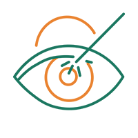 Phẫu thuật mộng thịt